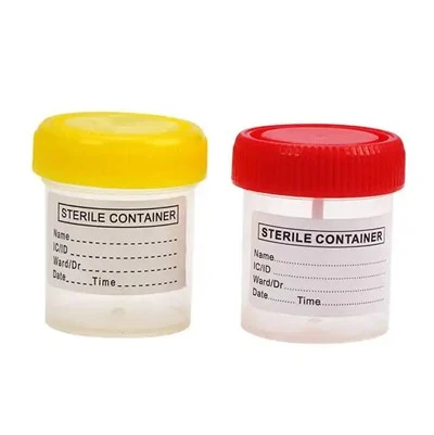 Medische steriele plastic monsterbeker urinecontainer